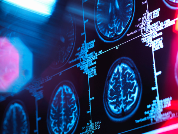 human brain scan in a neurology