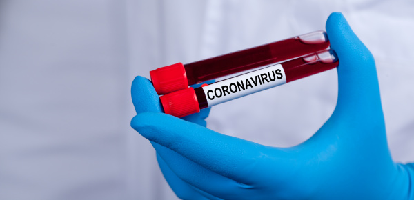 coronavirus 2019 ncov blood sample