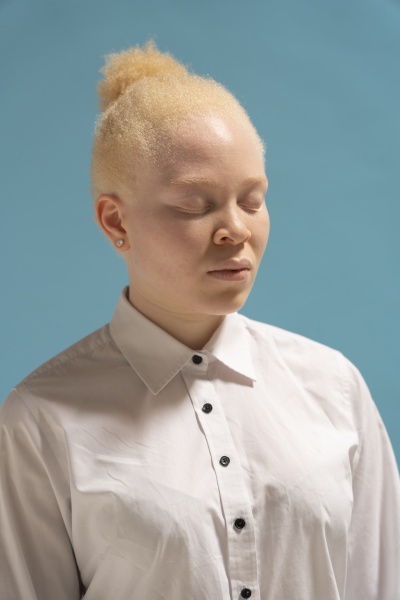 studio portrait of albino woman in
