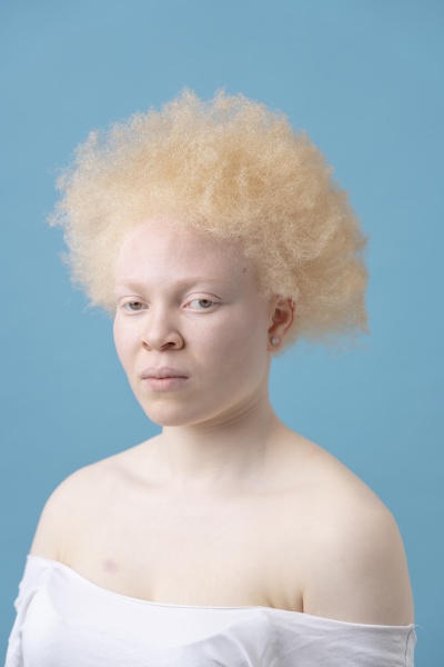 studio portrait of albino woman