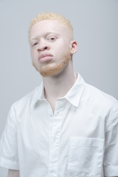 studio portrait of albino man in