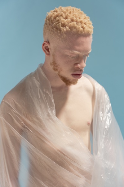 studio portrait of shirtless albino man