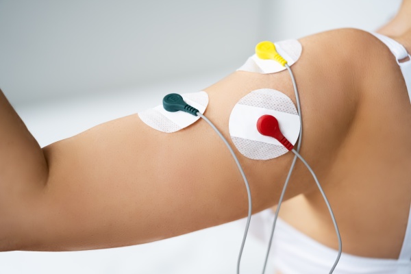 electrode arm stimulation and training