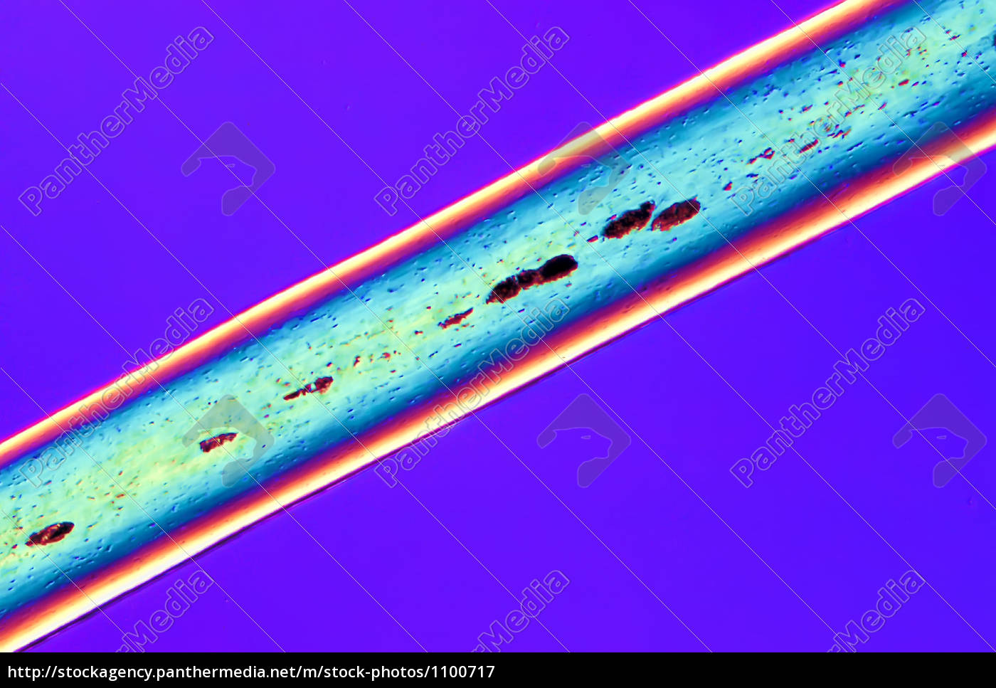 human hair microscopic - Stock Photo 
