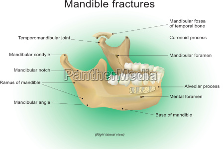 Anatomy of mandible fractures. - Stock Photo #23346835 | PantherMedia ...