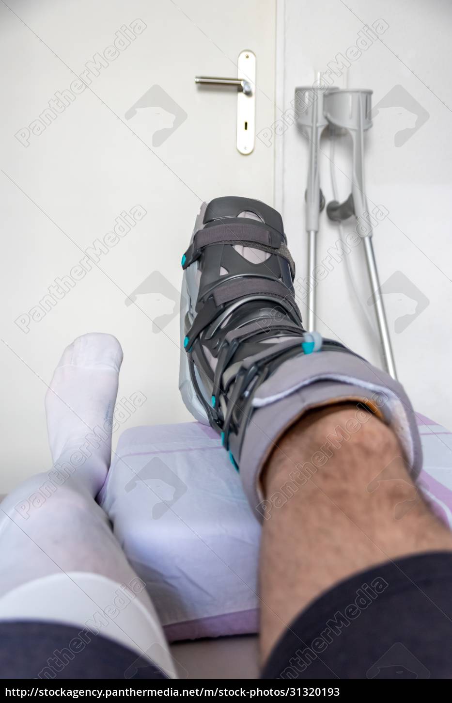 European man after Achilles tendon rupture operation - Stock Photo ...